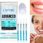 80% Off V-Whitening Gel Advanced Teeth Whitening Kit Voucher
