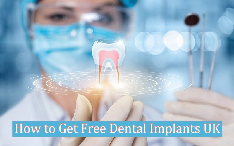 Free Dental Implants UK
